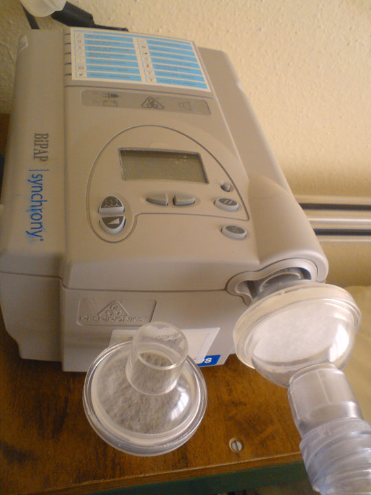Ventilação mecânica na crise de asma aguda